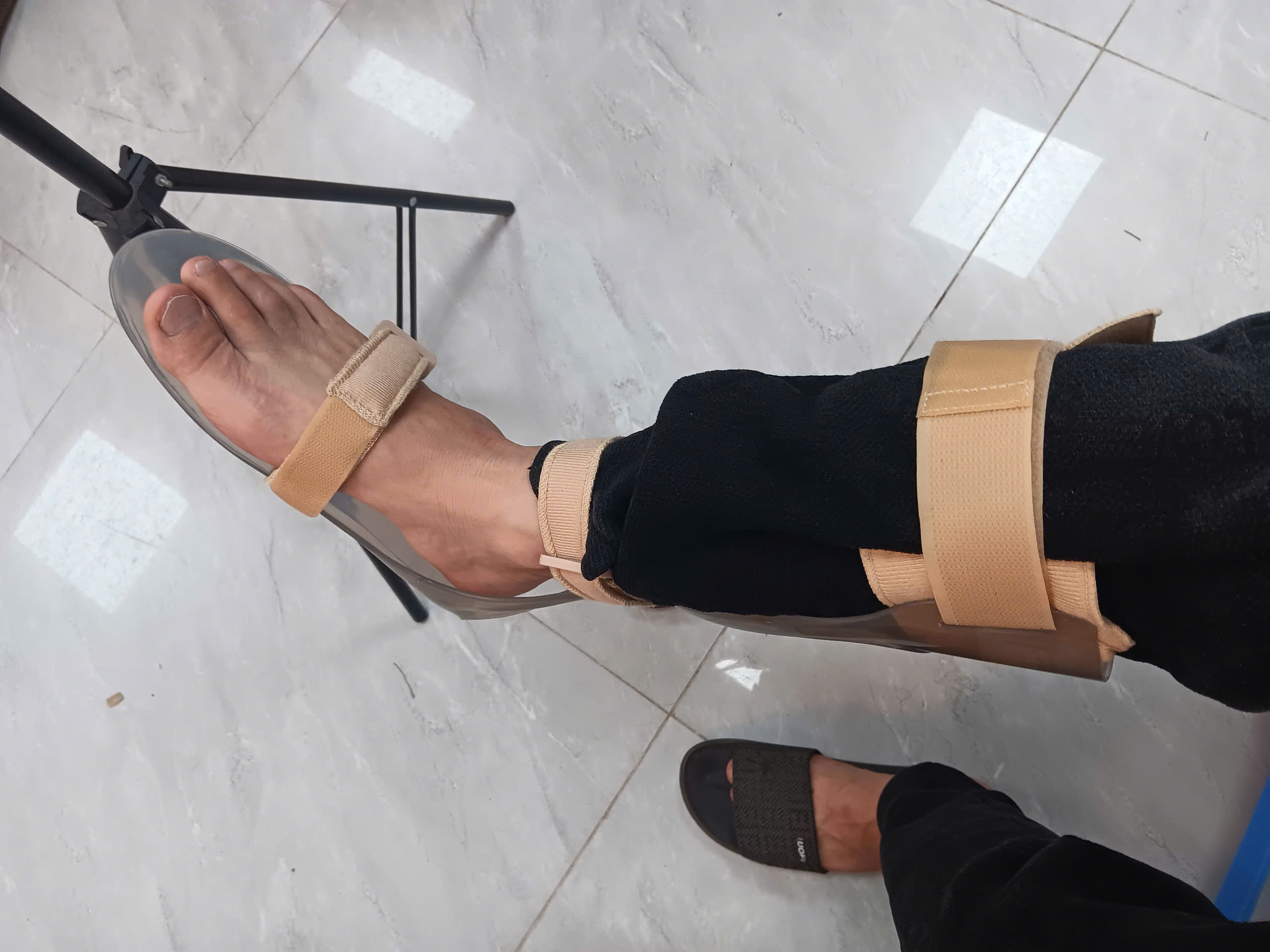 Nẹp Thả Chân SunOrthotech SPKA516 – Nẹp Chỉnh Bước Đi Cho Người Tai Biến 8 z6647388127077 275cd36834f8a711acd46b5587556643
