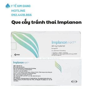Cấy Que Tránh Thai Implanon – Giải Pháp Ngừa Thai 3 Năm Được Nhiều Phụ Nữ Lựa Chọn 2 que cay implanon 2