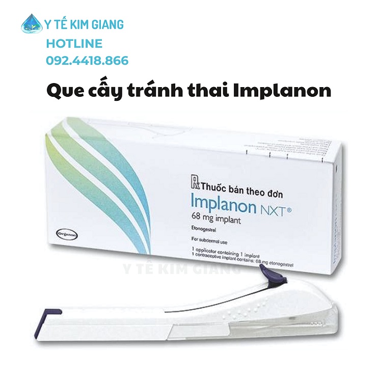 Que Tránh Thai Implanon Chính Hãng – Giải Pháp Tránh Thai Dài Hạn Hiệu Quả 3 Năm 2 que cay implanon 3