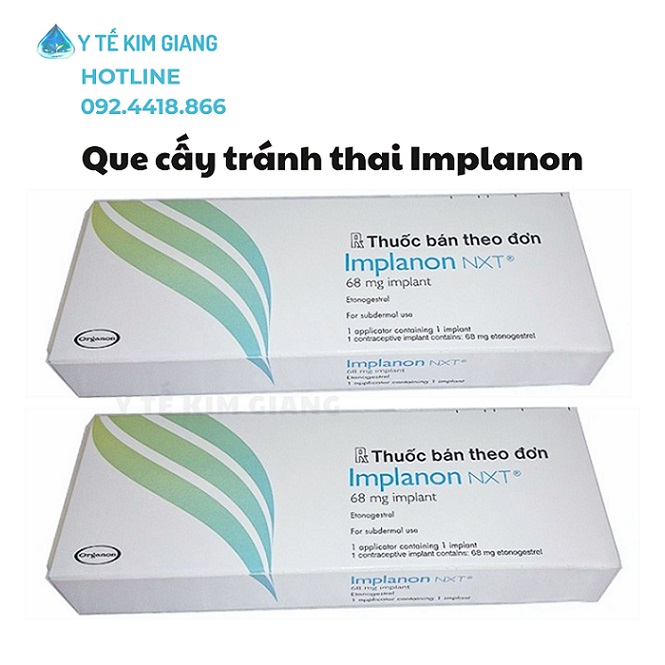 Que Tránh Thai Implanon Chính Hãng – Giải Pháp Tránh Thai Dài Hạn Hiệu Quả 3 Năm 3 que cay implanon