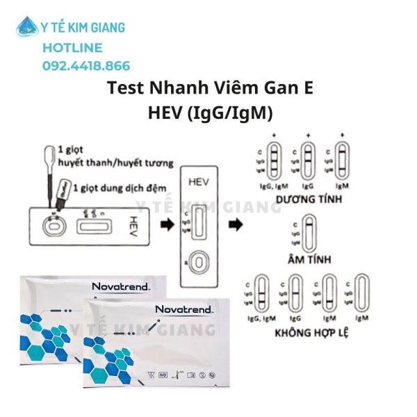 Xét Nghiệm Viêm Gan E Bằng Test Kiểm Tra Viêm Gan E Novatrend Nhanh Chỉ 15 Phút 3 1novatrend hev igg igm 2