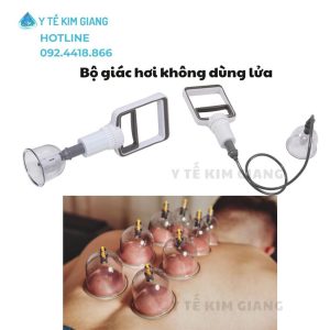 Bộ Giác Hơi Không Dùng Lửa Cao Cấp – 1 Giải Pháp Giảm Đau Mỏi, Thư Giãn Tại Nhà Được Ưa Chuộng